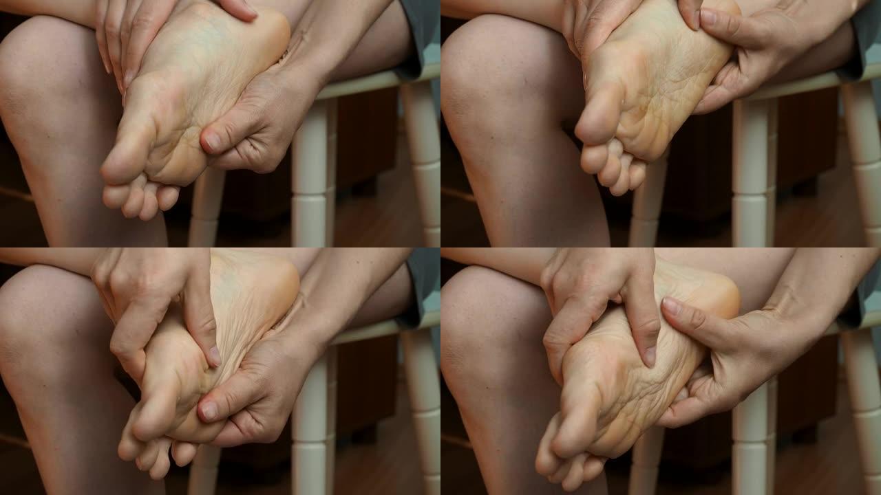 女人给自己1英尺按摩。女性摩擦脚掌以改善血液循环。