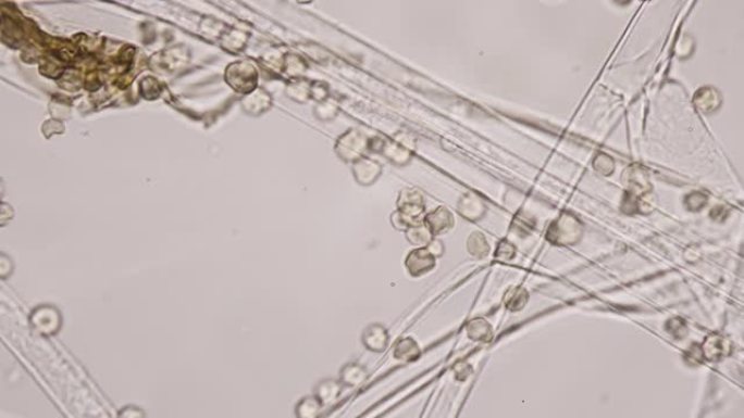 模具或模具。霉菌球形孢子特写。真菌王国的繁殖。真菌以称为菌丝的多细胞细丝的形式生长。有毒化合物或霉菌