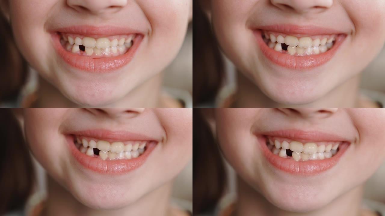 特写嘴孩子掉了一颗乳牙。更换永久更换的牙齿，无牙微笑和牙龈孔。儿童是牙科概念