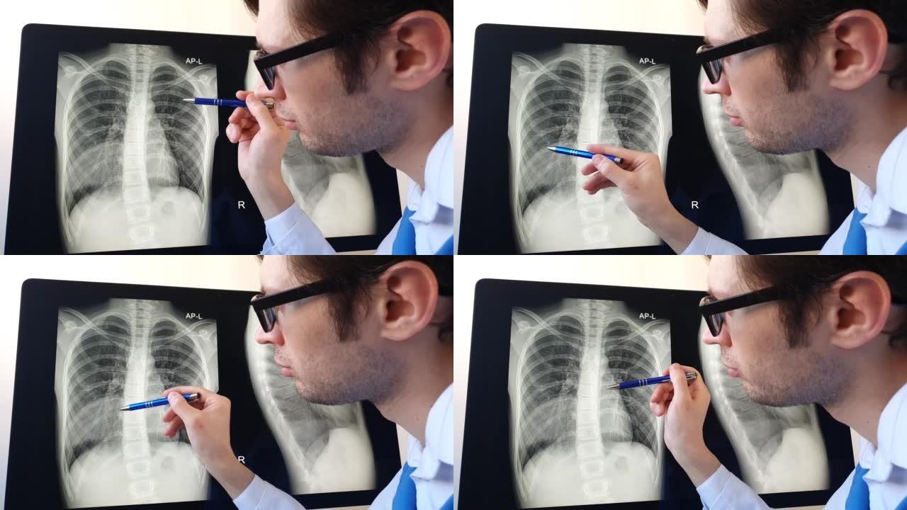 放射科医生分析右半胸肺肺炎的胸部x光。