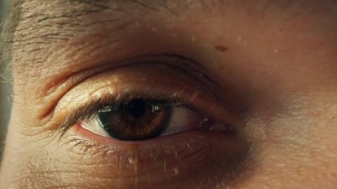 纤维瘤的人的眼睛的宏观镜头。男性皮肤上的纤维瘤。皮肤护理纤维瘤。