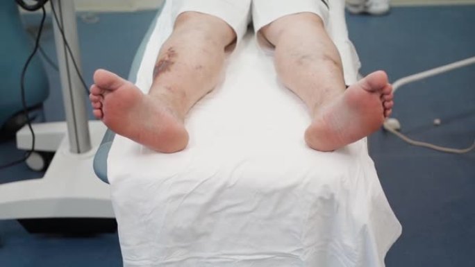 冻伤腿的病人躺在医院的手术台上。男性腿部酸痛