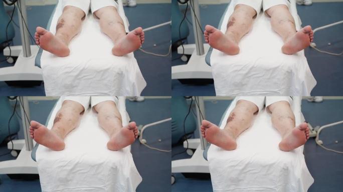 冻伤腿的病人躺在医院的手术台上。男性腿部酸痛
