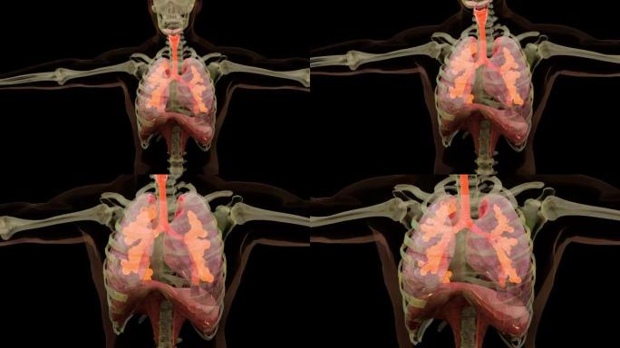人体呼吸系统肺解剖动画概念。可见肺，肺通气，气管，逼真的高质量3d医学动画