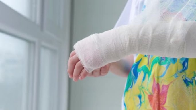 一个孩子手臂骨折的特写镜头。女孩握着折叠在多色t恤背景下的手。手上有石膏的孩子