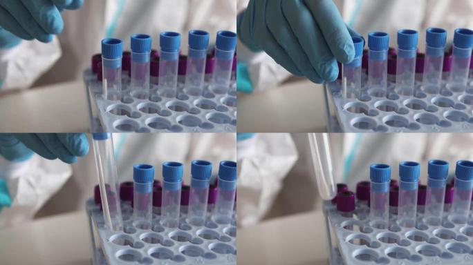 实验室护士冠状病毒PCR抗原检测过程，新型冠状病毒肺炎拭子采集试剂盒，OP NP患者标本试管，接受检