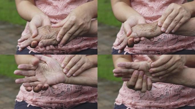 护理人员按摩痛风肿胀的老年妇女的手指和手腕。