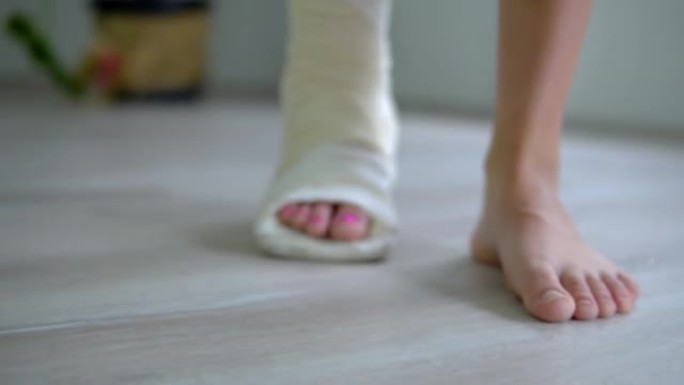腿部受伤后在家康复时，脚部骨折的女人试图走小步