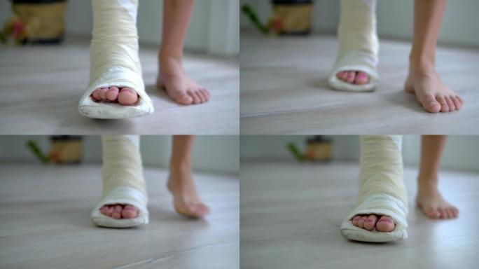 腿部受伤后在家康复时，脚部骨折的女人试图走小步