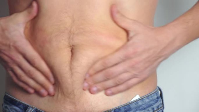 男性腹部,超重。一个赤裸着腹部的男人摇动着他腹部的脂肪褶皱