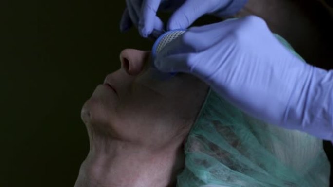 技术人员或医生在刚接受手术切除白内障的高级女性的眼睛上放置了防护罩。