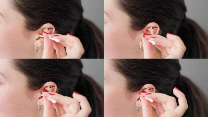 年轻白人妇女的脸部特写用棉签用耳环清洁耳朵。耳朵的卫生和健康