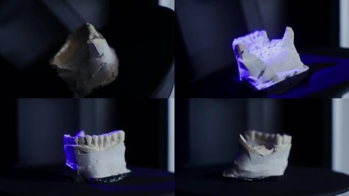 正畸医生通过组装颌骨来增加石膏的一部分