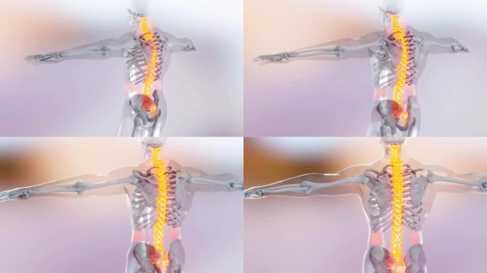 脊髓脊柱颈椎人体骨骼系统解剖动画概念。骨干上的红色，痛苦的脊柱的医学精确动画，男性受伤的骨干，3D渲