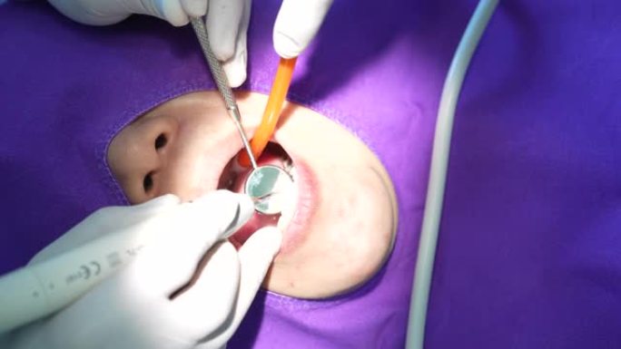 牙医在牙医诊所复制模型牙齿的特写镜头