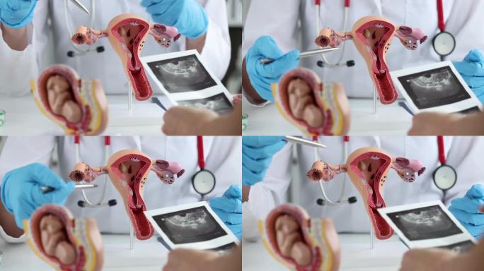 医生在子宫人工模型上向患者解释卵巢的变化并显示超声图像4k电影