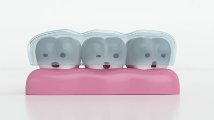 隐形牙套，隐形牙套，带隐形牙套的快乐牙齿，3d动画