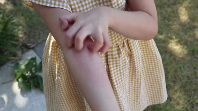 小女孩有皮疹过敏，手臂发痒