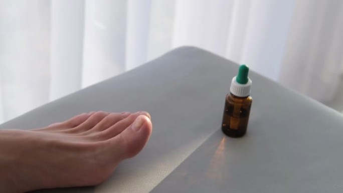 医生戴着手套检查指甲上有真菌的1英尺特写镜头。甲癣: 指甲从甲床上脱离。
