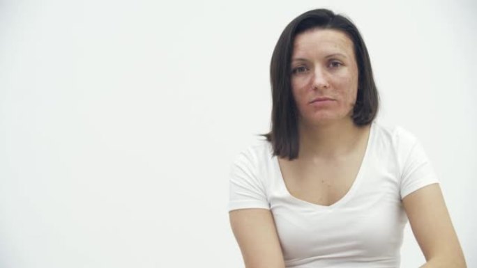 女性面部皮肤问题的4k视频。