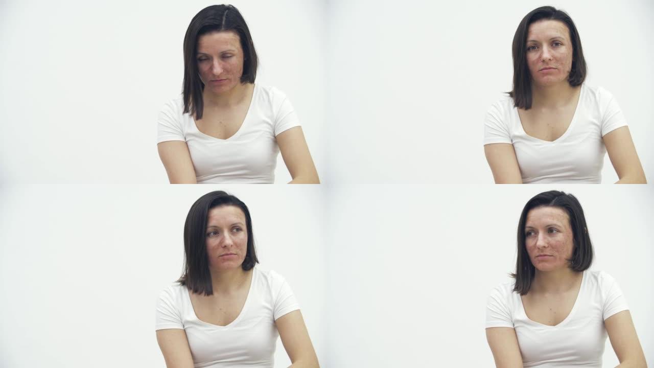 女性面部皮肤问题的4k视频。