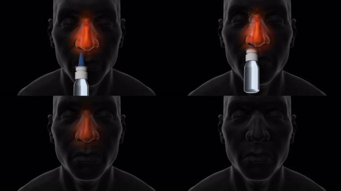 减充血剂鼻喷雾剂-男性前视图-黑色背景