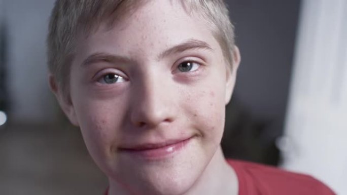 患有唐氏综合症的快乐男孩的肖像。残疾儿童的日常生活。儿童染色体遗传疾病。