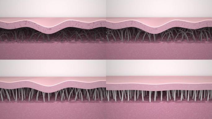 皱纹平滑。医学3d动画显示了皮肤年轻化，胶原蛋白和弹性纤维的重建，去除皱纹和紧致皮肤的过程。抗衰老治