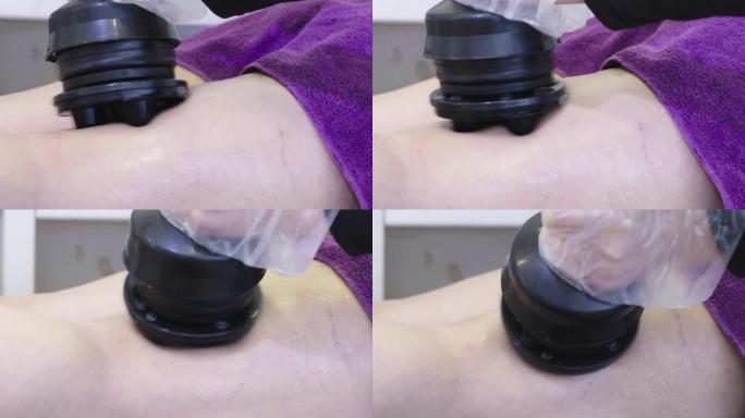 振动按摩的4k视频镜头在美容院中通过按摩机应用于女性的腿部。