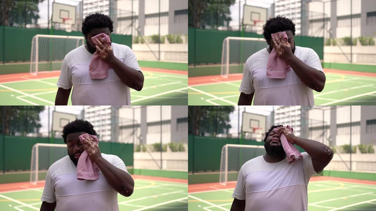 黑人白癜风男子篮球比赛后擦干脸