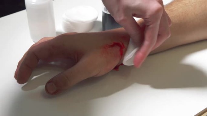 狗咬伤，手割伤后伤口的治疗