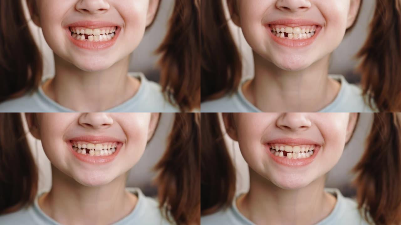 一个小女孩的特写笑脸。一个7-8岁的漂亮小女孩掉了乳牙。乳牙脱落，恒牙更换。儿童是牙科