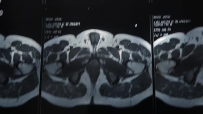 一名男子在家里的窗户上从臀部断层扫描的横向图像中查看细节