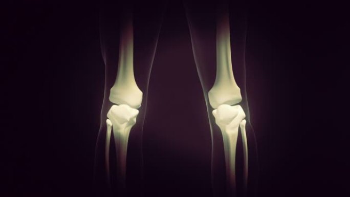 膝关节疼痛的医学概念