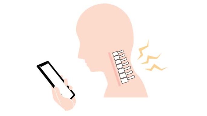 这是一个动画视频，展示了直颈 (智能手机颈部) 如何导致颈部和肩部疼痛。