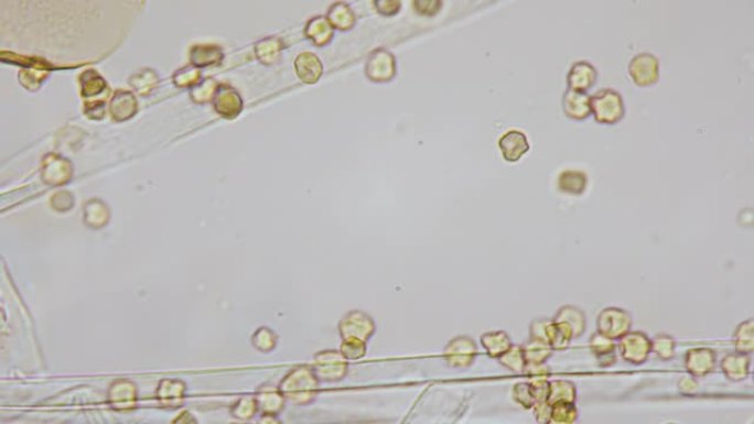 研究实验室显微镜下的真菌王国。1000倍放大倍数的蘑菇孢子。人类危险过敏原