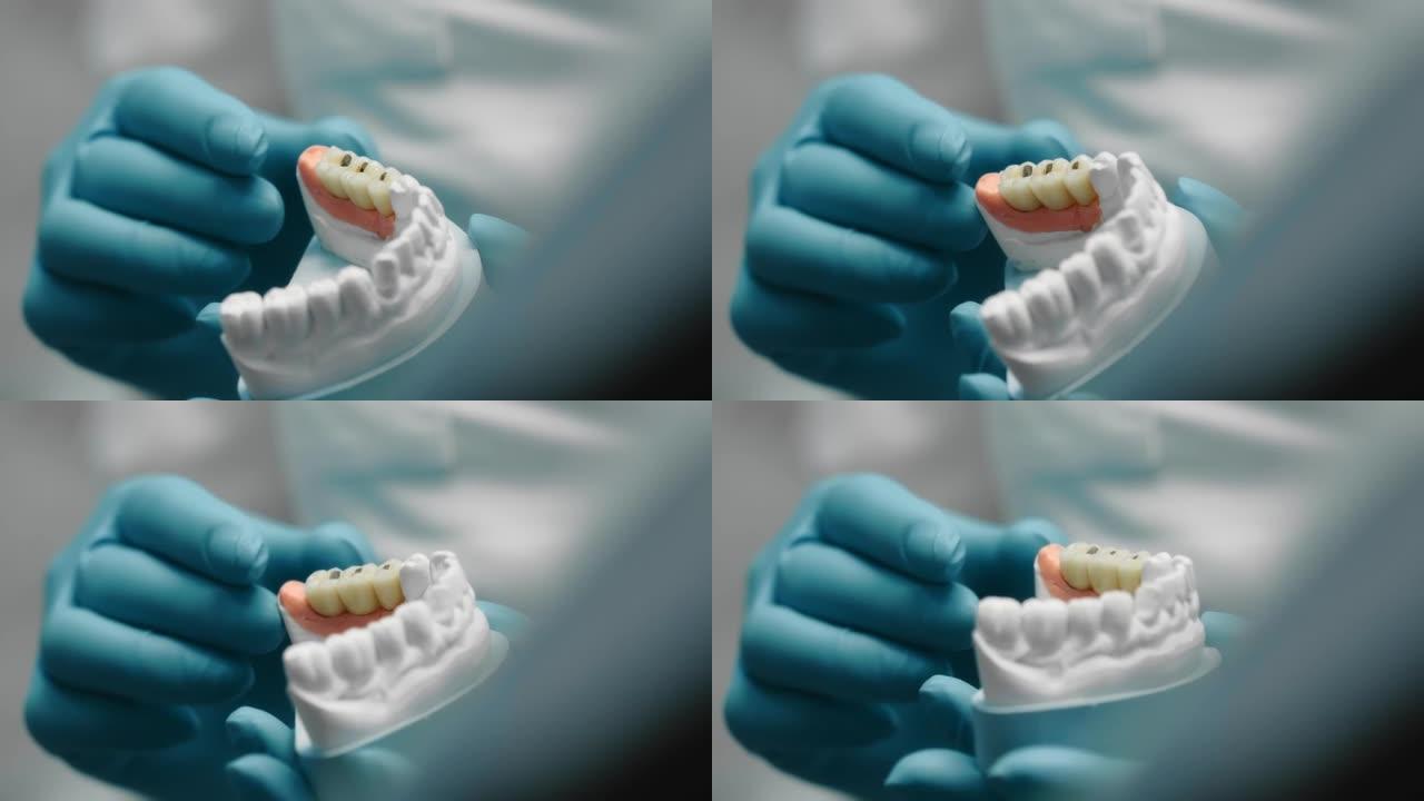 戴着手套的牙科技师的手拿着牙齿的石膏模型