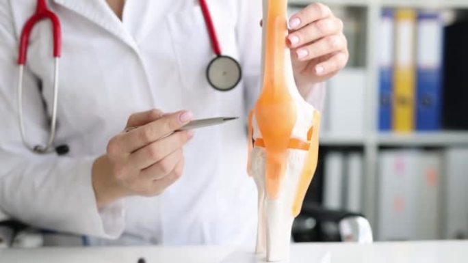 医生展示了人体膝关节结构的解剖