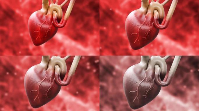 当凝块阻塞血液流向心脏时，就会发生心脏病发作或急性心肌梗塞