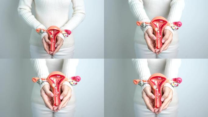 妇女抱着子宫和卵巢模型。卵巢癌和宫颈癌，子宫颈疾病，子宫内膜异位症，子宫切除术，子宫肌瘤，生殖系统和