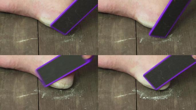 紫丁香刮刀去除男人脚后跟的死皮。