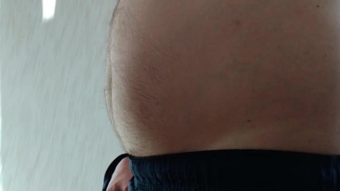 一个因肥胖而大肚子的男人