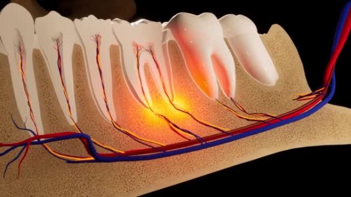 牙痛。牙齿的解剖详细部分。神经发炎。3D动画