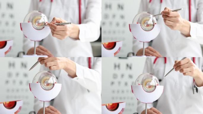 眼科医生在模型上显示人眼的结构