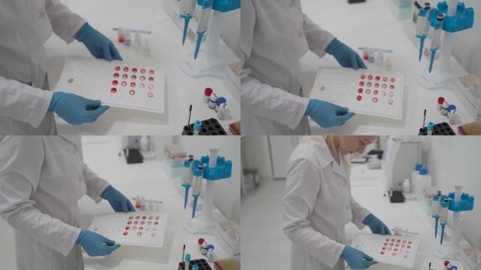 血型的实验室测定。验血。女实验室助理做血液检查，将血液样本放在图表上的细胞中，以确定组和Rh因子。接