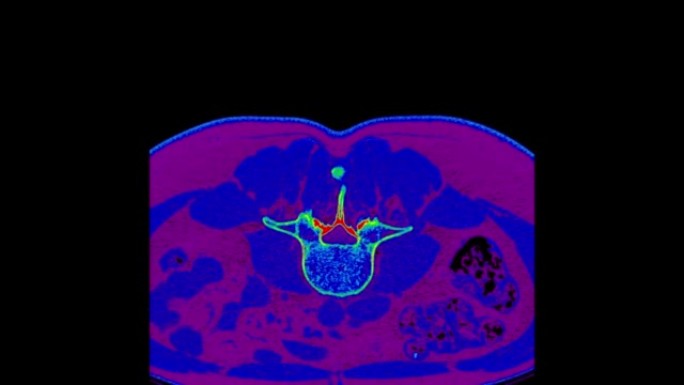 大脑MR扫描颜色。