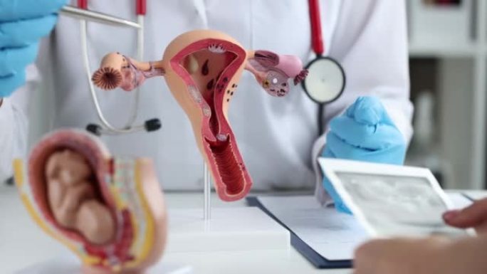 医生在子宫人工解剖模型上展示女性生殖系统疾病特写4k电影