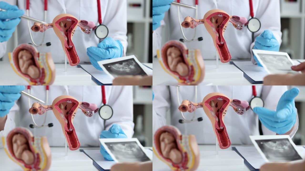 医生在子宫人工解剖模型上展示女性生殖系统疾病特写4k电影