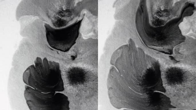 垂直视频墨水水滴黑色污渍纹理
