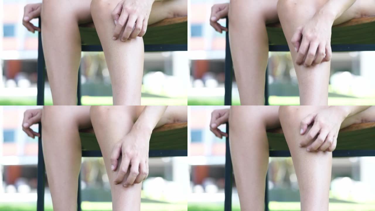 一名妇女抓挠腿脚，皮肤发痒，皮肤干燥和皮炎引起的皮疹。